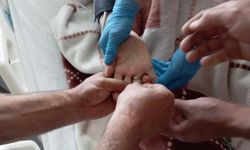 Elbistan’da Yaşlı Kadının Sıkışan Yüzüğü Kesilerek Çıkarıldı